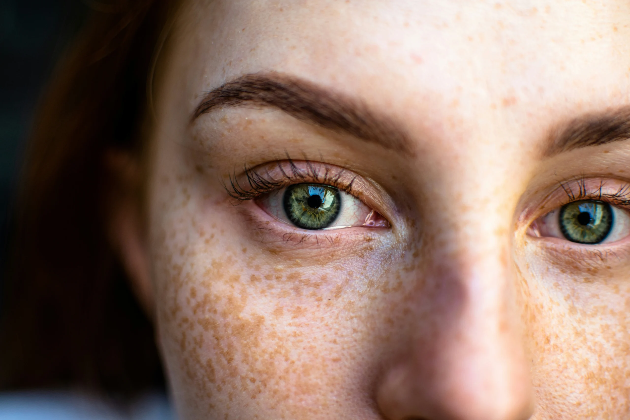 Before image showing visible facial pigmentation