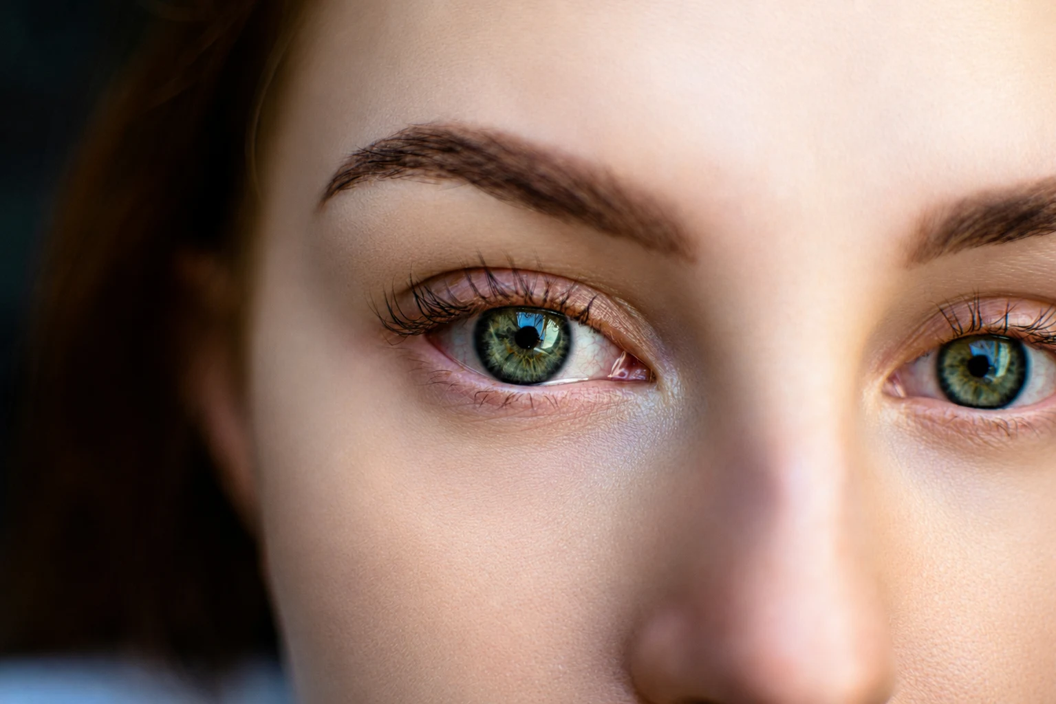 After image showing smoother, more even-looking skin