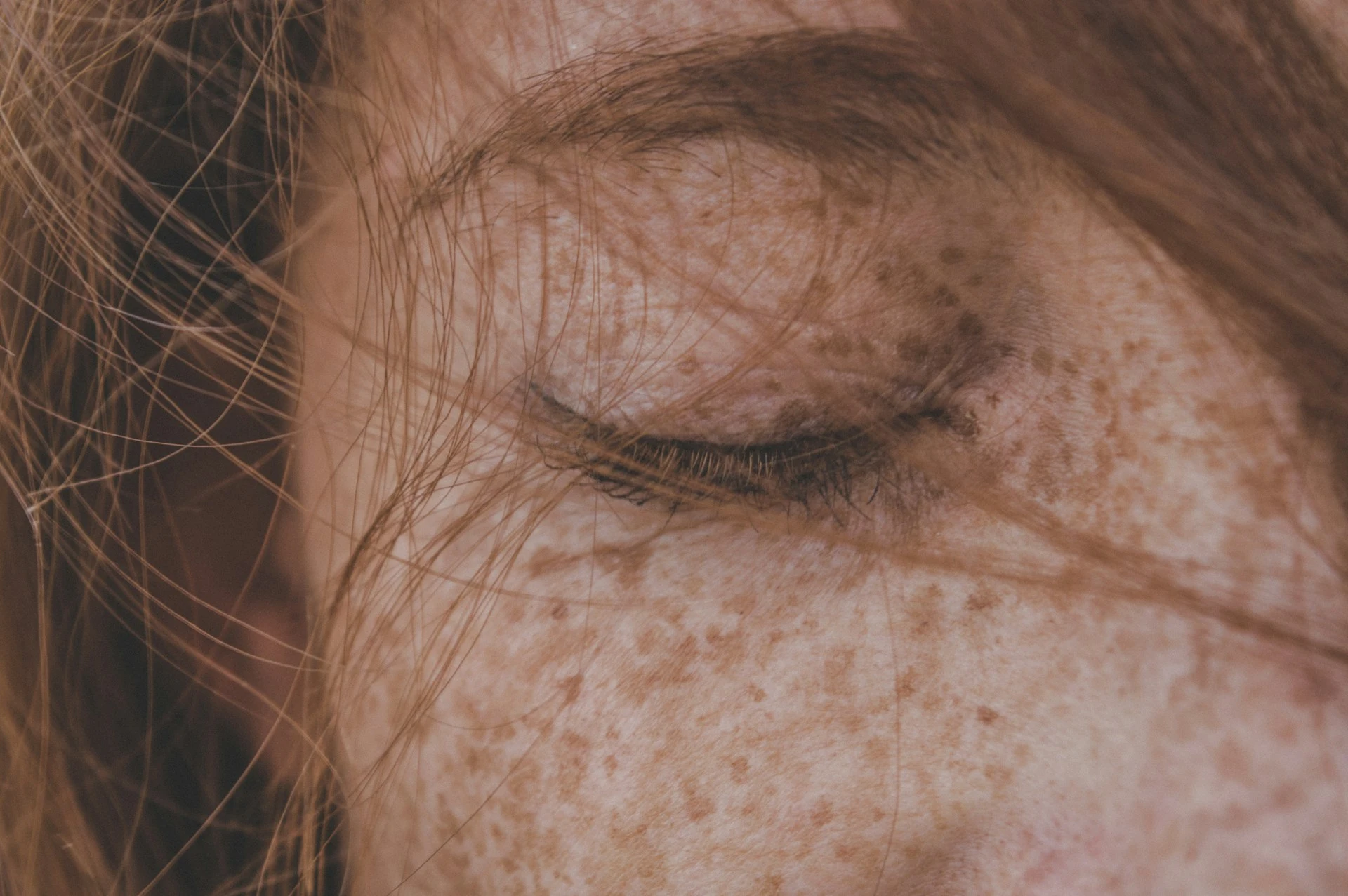 Skin pigmentation visual